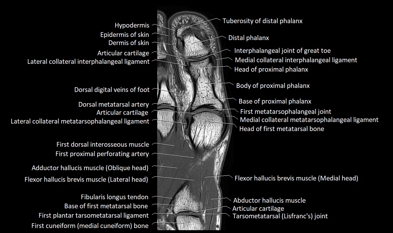 Great Toe micro anatomy MRI axial cross sectional 3T image 15.webp